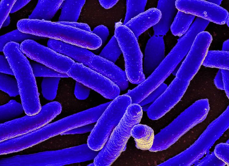 Scanning electron micrograph of Escherichia coli