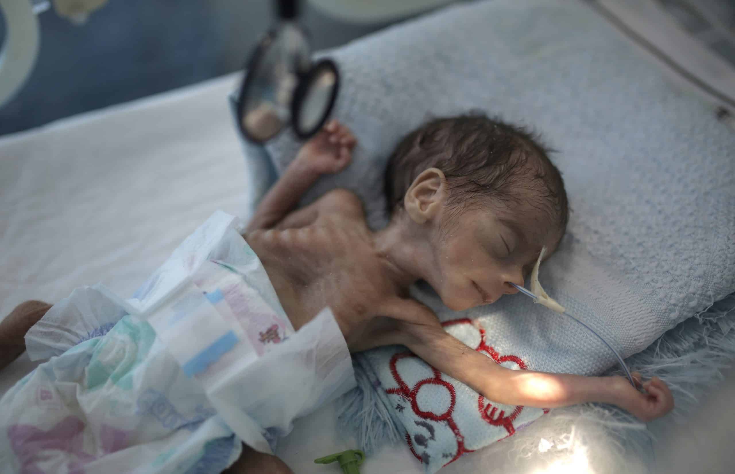 UK ‘complicit’ in Yemen suffering if aid halved, former minister warns