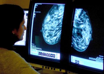 Embargoed to 0001 Wednesday November 20 File photo dated 15/06/06 of a consultant analyzing a mammogram. Simple arthritis drugs used on the NHS could help stop breast cancer spreading, research suggests.