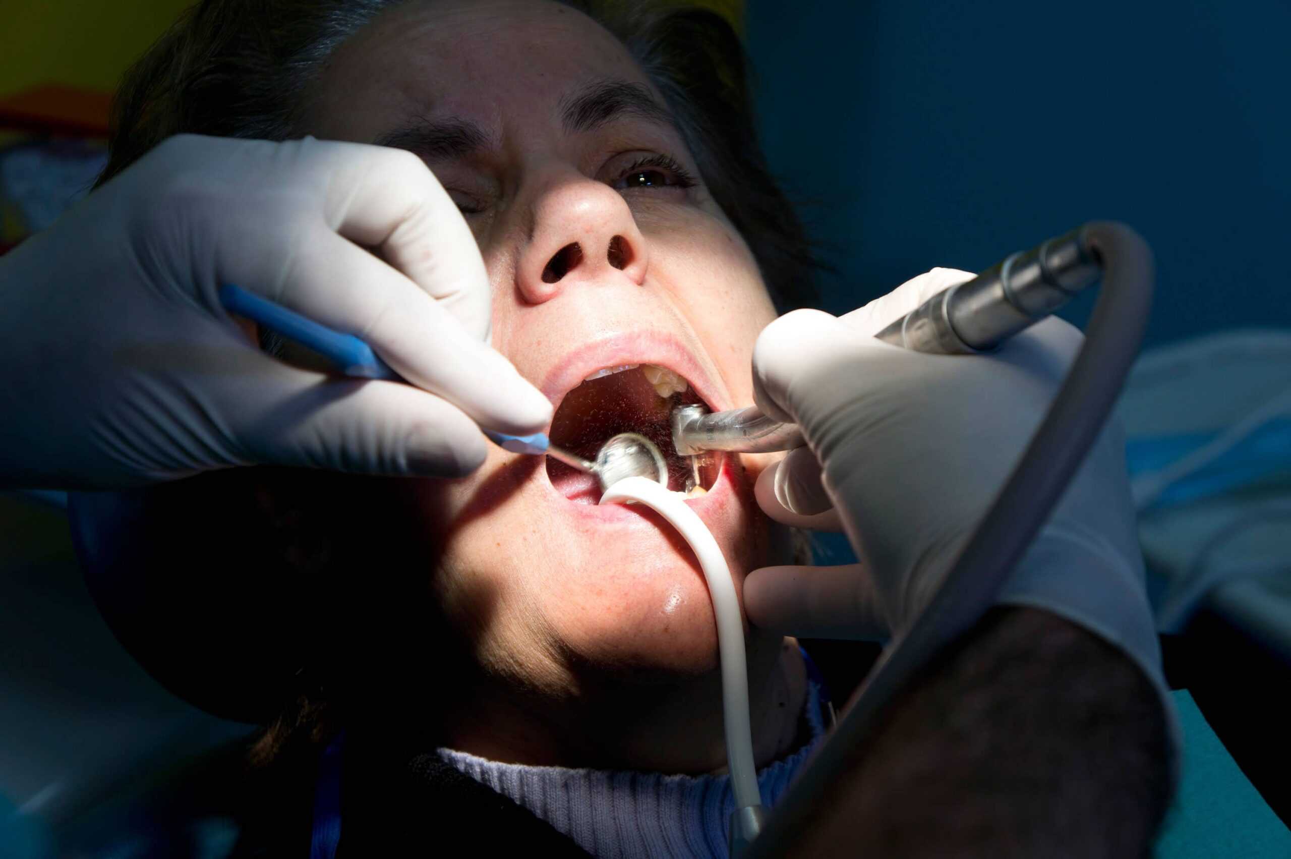 Govt accidentally leaks its dentistry plan to MPs of all parties